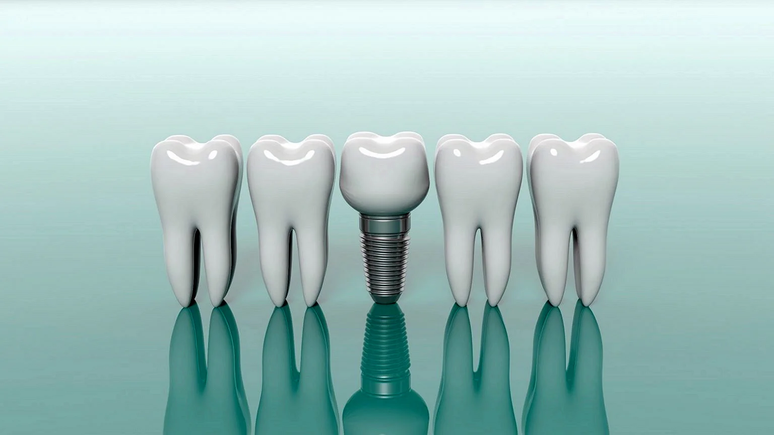 Dental Implant 3d Wallpaper